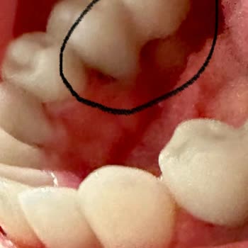 Dentasay'da Yaşanan Diş Tedavisi Kabusu