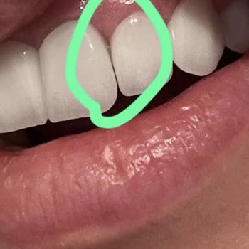 Dentasay'da Yaşanan Diş Tedavisi Kabusu