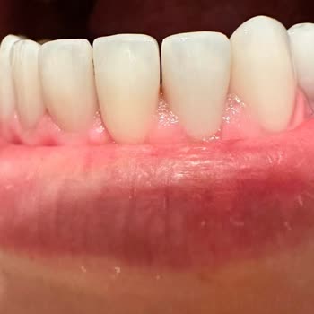Dentasay'da Yaşanan Diş Tedavisi Kabusu