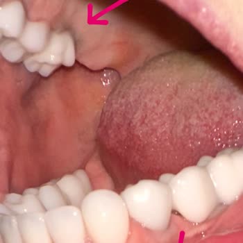 Dentasay'da Yaşanan Diş Tedavisi Kabusu