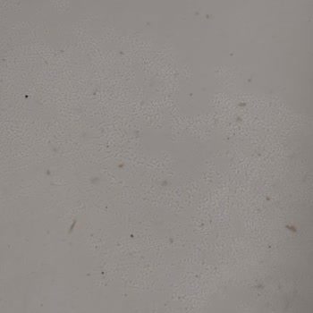 Richmond Nua Beş Yıldızlı Kabus: Hijyen ve Hizmet Skandalı