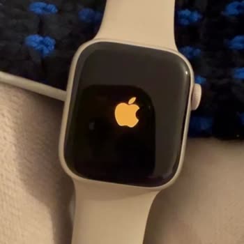 Apple Watch 7'nin Garanti Sonrası Sorunları Ve Destek Eksikliği