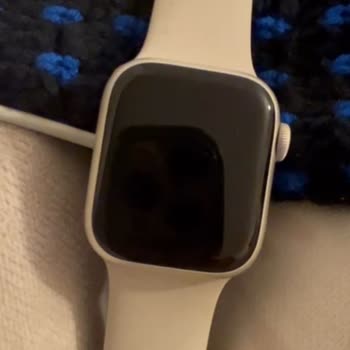 Apple Watch 7'nin Garanti Sonrası Sorunları Ve Destek Eksikliği
