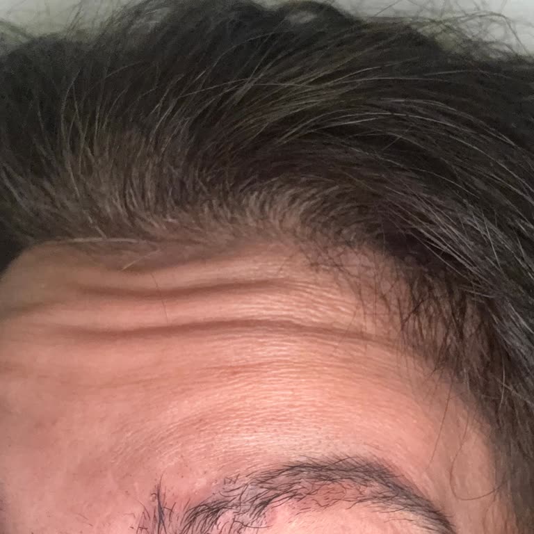 Yanıltıcı Kaş Silme Hizmeti