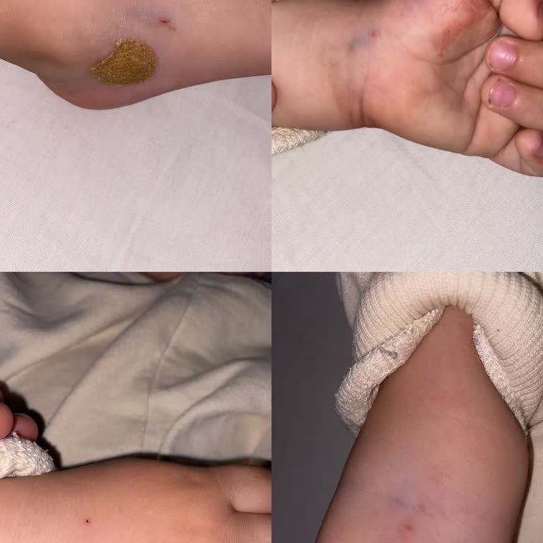 Hastanede Yetersiz Damar Yolu Açma Deneyimi