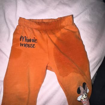 Molfix Bebek Bezlerinde Sızdırma Sorunu Ve Yetersiz Müşteri Hizmeti