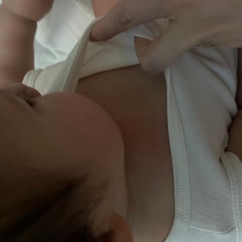 Bebek Bezi Alerjisi: Goon Markasıyla Yaşanan Sorun