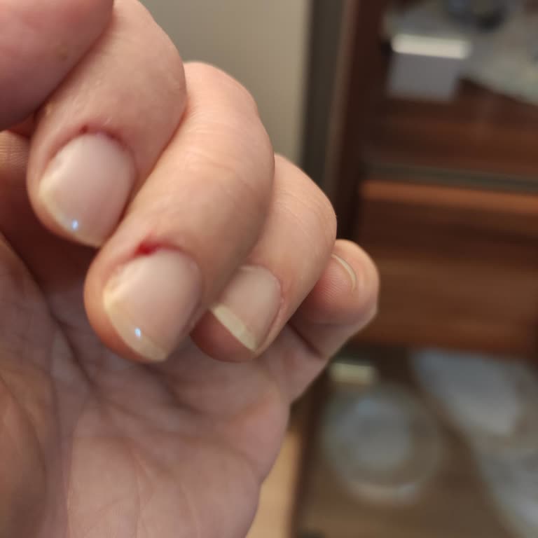 Yanlış Bilgi Ve Hatalı Hizmet Sonrası Mağduriyet