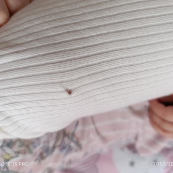 Cigit Kids İlk Kullanımda Deforme Olan Ürün!
