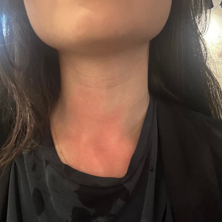 Kahve Sleeve'leri Yüzünden Yanık Tehlikesi