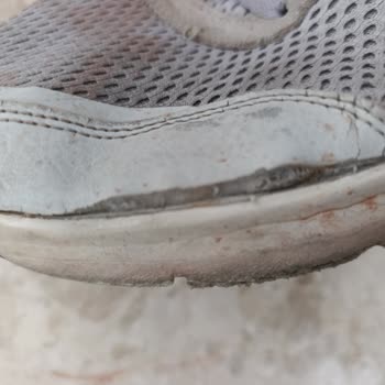 Skechers Ayakkabının Garanti Süresi Ve Kalite Sorunu