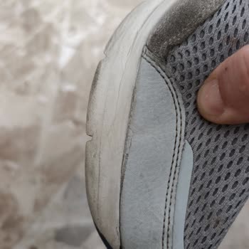 Skechers Ayakkabının Garanti Süresi Ve Kalite Sorunu
