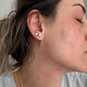 Solante Pigmenta Ürünü Alerji Sorunu