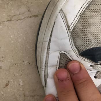 Ayakkabıda Üretim Hatası Mağduriyeti