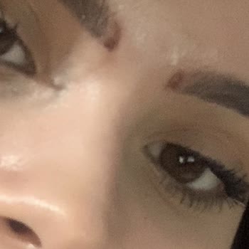 Dilan Polat Estetik Mikroblading İşlemindeki Hatalar Ve Kalıcı İzler!