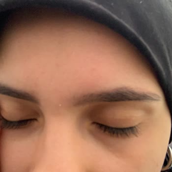 Dilan Polat Estetik Mikroblading İşlemindeki Hatalar Ve Kalıcı İzler!