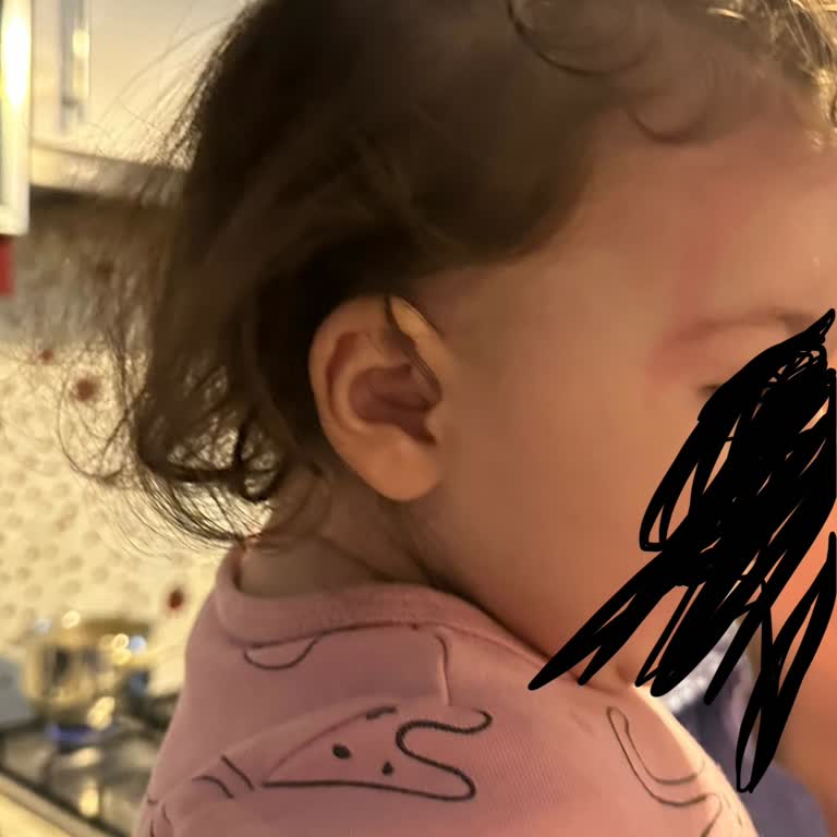 Bebek Cildine Zarar Veren Dalin Sprey