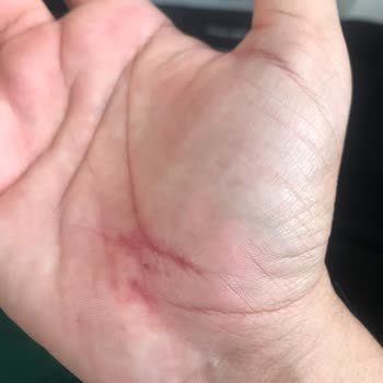 Navee N65 Scooter Fren Arızasıyla Yaşanan Tehlikeli Kaza