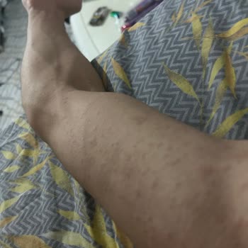 Sağlık Sorunları Yaratan Ürün