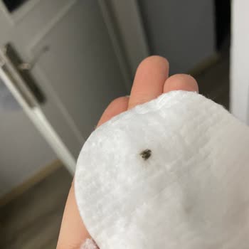 Watsons Ürününde Hijyen Skandalı