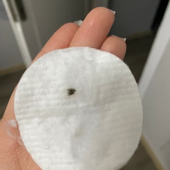 Watsons Ürününde Hijyen Skandalı