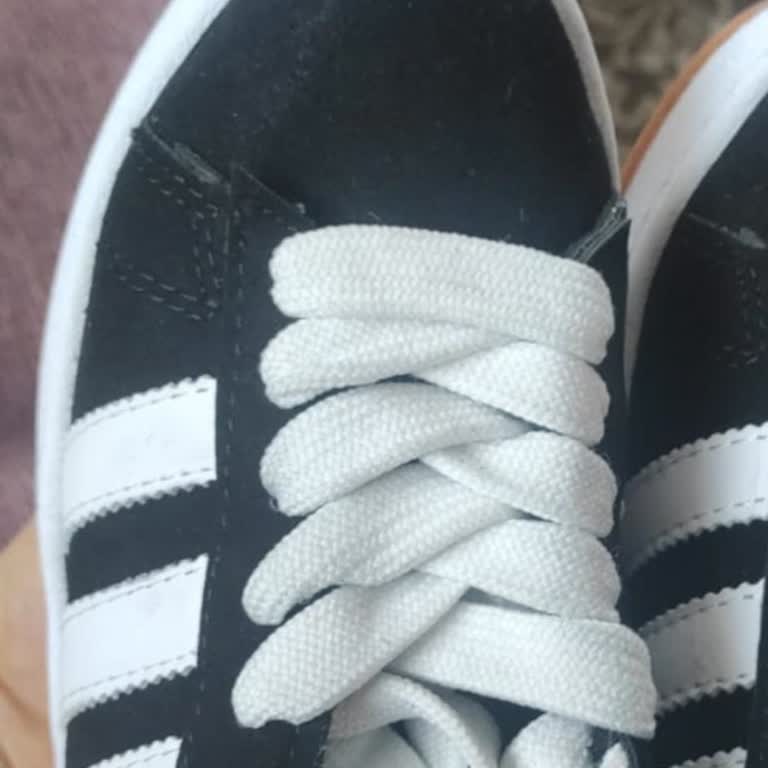 İlgisiz Müşteri Hizmeti Ve Kalitesiz Ürün Deneyimi