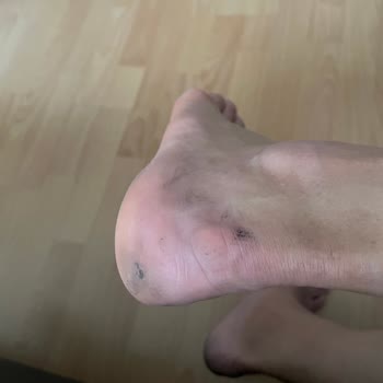 Boyner'den Aldığım Botlar Mağduriyet Yarattı!