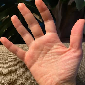 Dermodicos Plus Ürünleri Cildimde Ciddi Yan Etkilere Neden Oldu