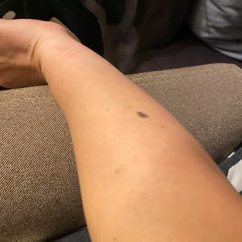 Dermodicos Plus Ürünleri Cildimde Ciddi Yan Etkilere Neden Oldu