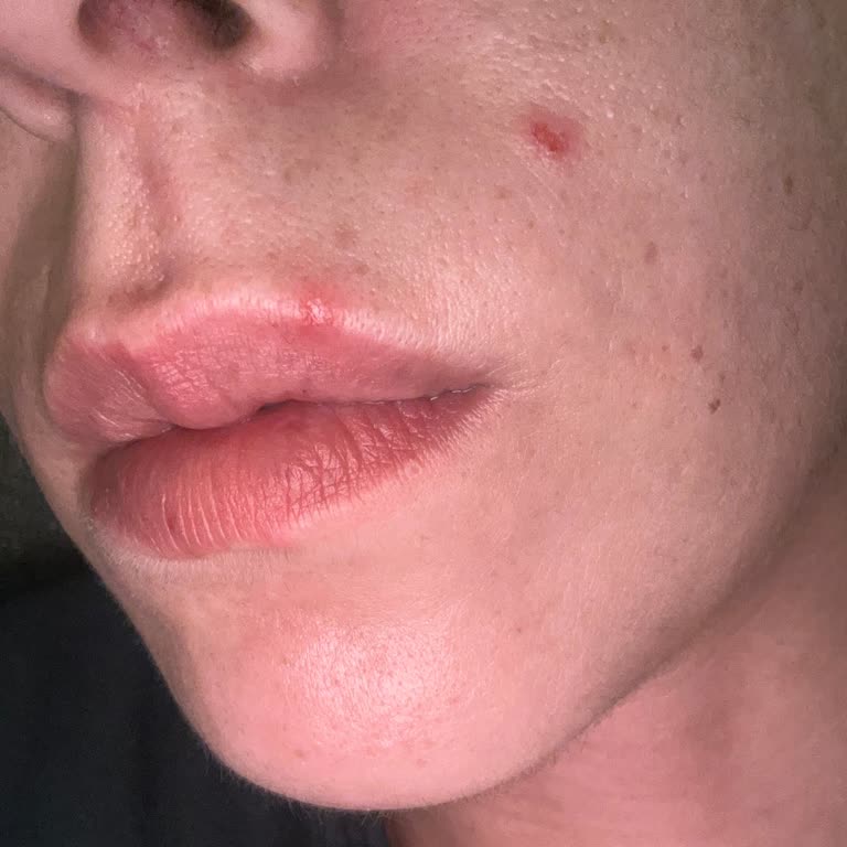 Estee Lauder Serum Cilt Sorunlarına Yol Açtı