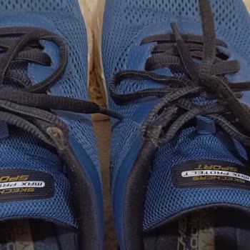 Skechers Ayakkabıda Kalitesizlik Ve Yetersiz Hizmet