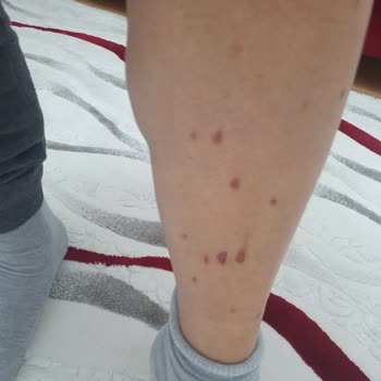 Düzensiz Seanslar Ve Yanlış Uygulama Mağduriyeti