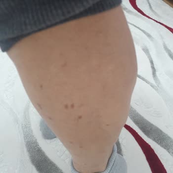 Düzensiz Seanslar Ve Yanlış Uygulama Mağduriyeti