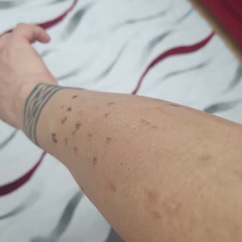 Düzensiz Seanslar Ve Yanlış Uygulama Mağduriyeti