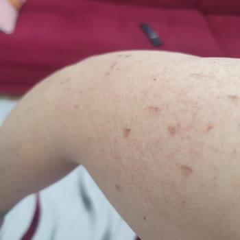 Düzensiz Seanslar Ve Yanlış Uygulama Mağduriyeti