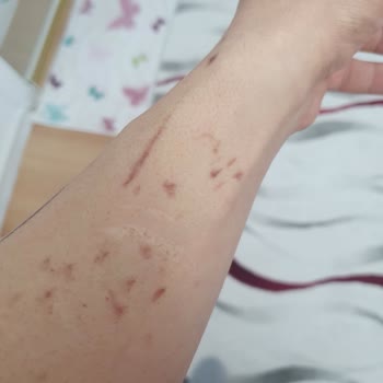 Düzensiz Seanslar Ve Yanlış Uygulama Mağduriyeti