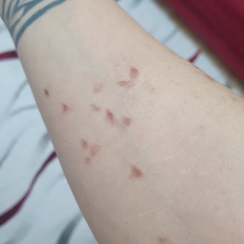 Düzensiz Seanslar Ve Yanlış Uygulama Mağduriyeti