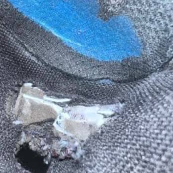 Skechers Ayakkabının Kalitesizliği Ve Yanıltıcı Kampanya