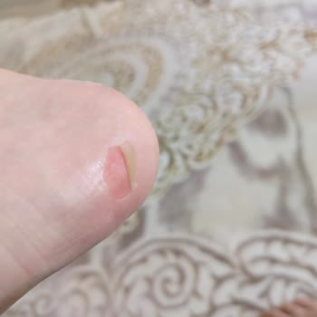 Polaris Botlar Ayaklarımı Mahvetti