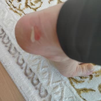 Polaris Botlar Ayaklarımı Mahvetti