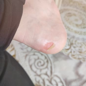 Polaris Botlar Ayaklarımı Mahvetti