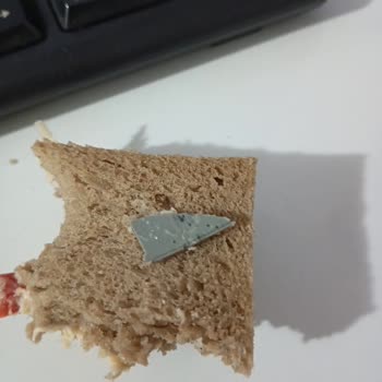 MR No Sandviçten Çıkan Plastik Parça Şoku