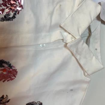 Lekeli Gömlek Ve Kapatılan Hesap: Trendyol'da Hayal Kırıklığı