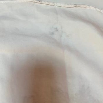 Lekeli Gömlek Ve Kapatılan Hesap: Trendyol'da Hayal Kırıklığı