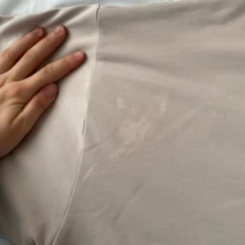 Roll-on Kıyafetlerimi Mahvetti, Müşteri Hizmetleri Çözüm Sunmuyor