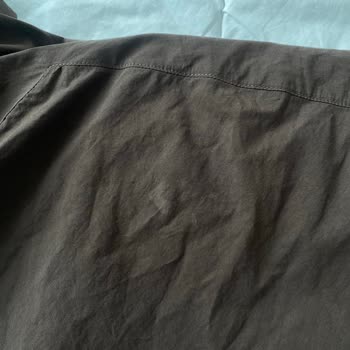 Roll-on Kıyafetlerimi Mahvetti, Müşteri Hizmetleri Çözüm Sunmuyor