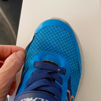 Skechers Ayakkabılarının Kalitesizliği Ve Garanti Sorunu