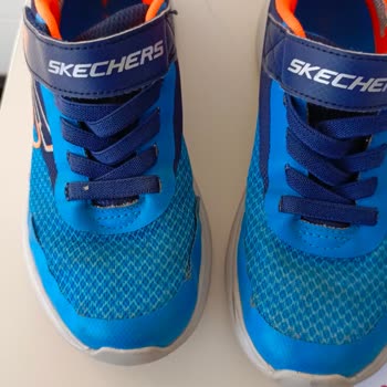 Skechers Ayakkabılarının Kalitesizliği Ve Garanti Sorunu