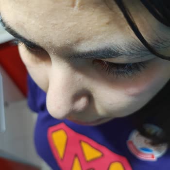 Yves Rocher Elixir Botanique Göz Kremi Alerjik Reaksiyon