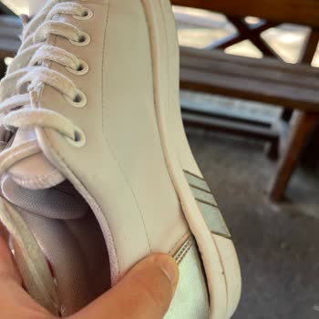 In Street Ayakkabı Ağrısı Ve Açılma Sorunu Çözüm Bekliyor